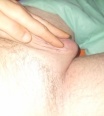 spidyx6