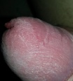 sukom