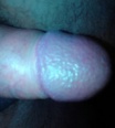 medvideksu