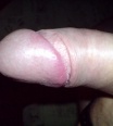 debhol