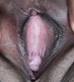 par28a26