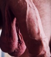 antraxbi